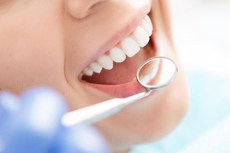 Examens Dentaires Dental Exams